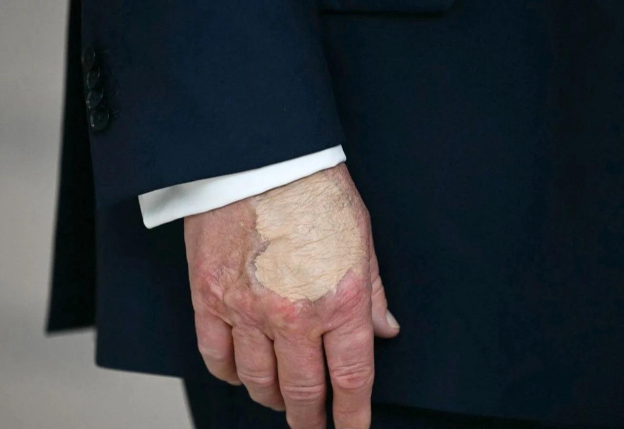 Trumpove ruke