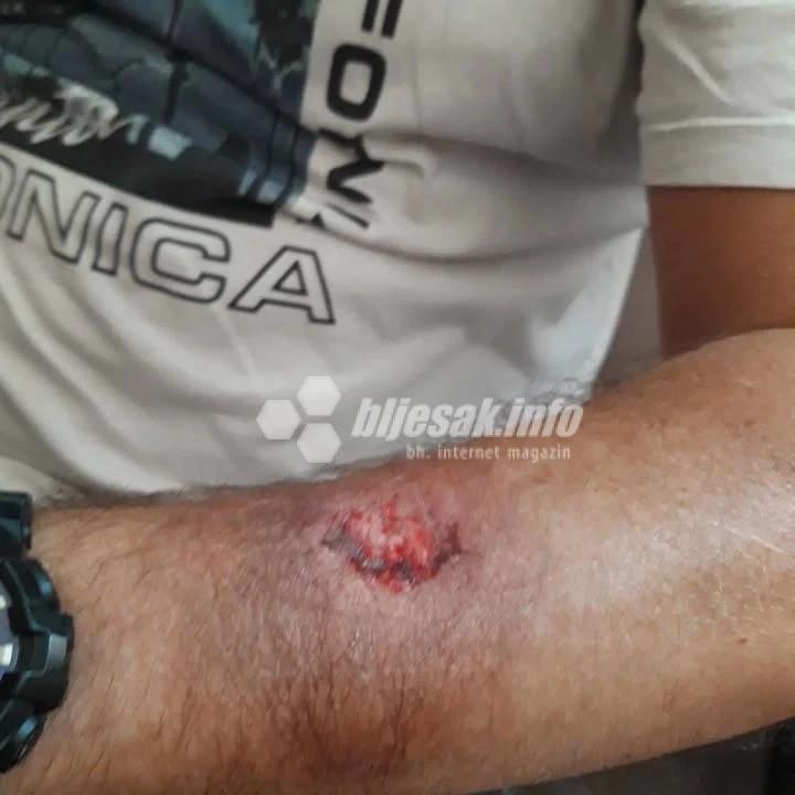Čitatelj tvrdi kako ga je žena ugrizla