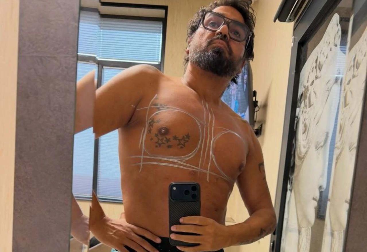Azis pokazao estetski zahvat