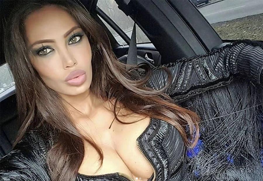Soraja Vučelić bori se za život nakon teške prometne nesreće